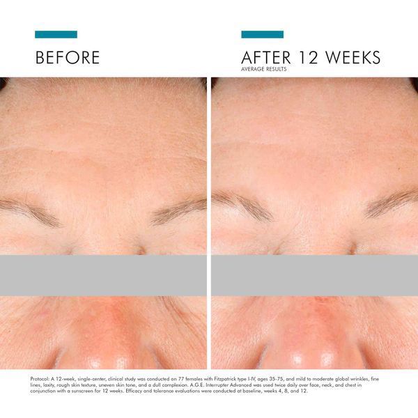 Косметичний засіб SkinCeuticals A.G.E. Interrupter Advanced, 50 мл КОСМ01491 фото