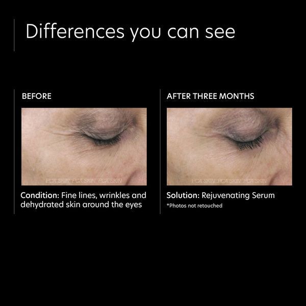 Косметичний засіб PCA Skin Rejuvenating Serum, 30 мл КОСМ01400 фото
