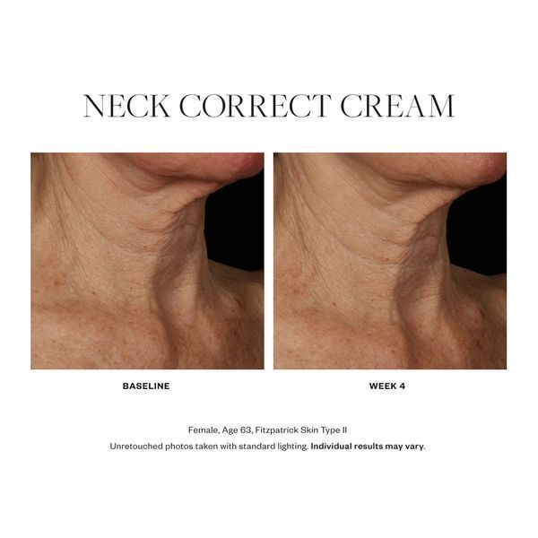 Косметичний засіб SkinMedica Neck Correct Cream, 59 мл КОСМ00251 фото
