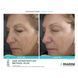 Косметичний засіб Jan Marini Age Intervention Retinol Plus, 30 мл КОСМ00601 фото 4