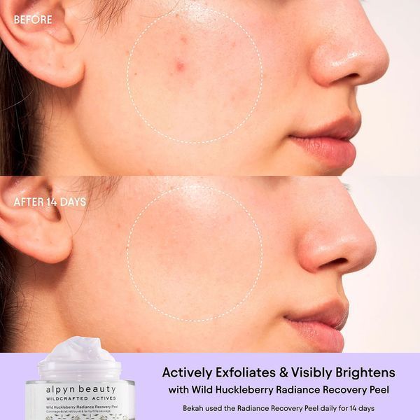 Косметичний засіб Alpyn Beauty Wild Huckleberry Radiance Recovery Peel, 50 мл КОСМ00602 фото