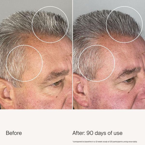Сыворотка для роста новых волос Living Proof Scalp Care Density Serum 50 мл 2462373610 фото