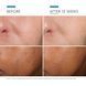 Косметичний засіб SkinCeuticals Phloretin CF, 30 мл КОСМ05303 фото 3