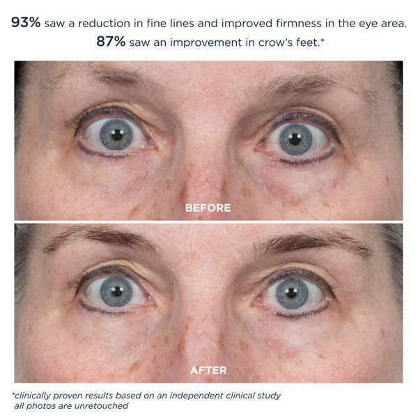 Косметичний засіб M-61 ProSmooth Retinol Eye Serum, 15 мл КОСМ02104 фото