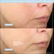 Мікрострумовий ліфтинг-пристрій NuFACE Trinity+ Complete Set КОСМ02404 фото 4