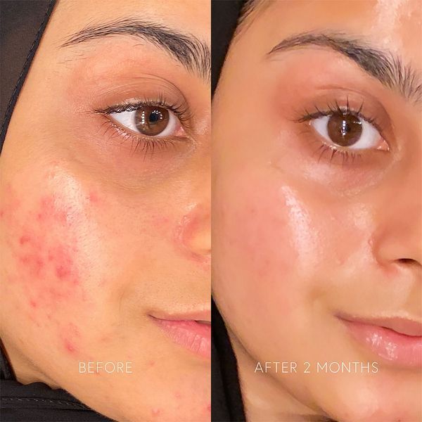 Очищувальний засіб Dr. Barbara Sturm Enzyme Cleanser, 74 мл КОСМ00055 фото