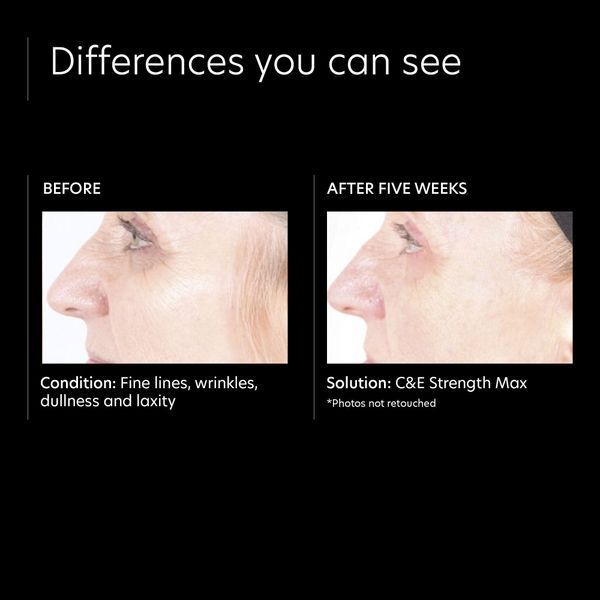Косметичний засіб PCA Skin CandE Strength Max, 30 мл КОСМ01405 фото
