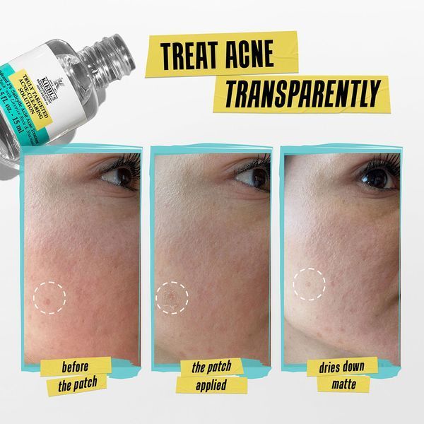 Косметичний засіб Kiehl's Since 1851 Truly Targeted Acne-Clearing Solution, 15 мл КОСМ05556 фото