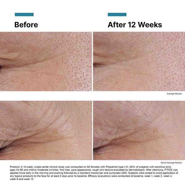 Косметичний засіб SkinCeuticals P-TIOX, 30 мл КОСМ00156 фото