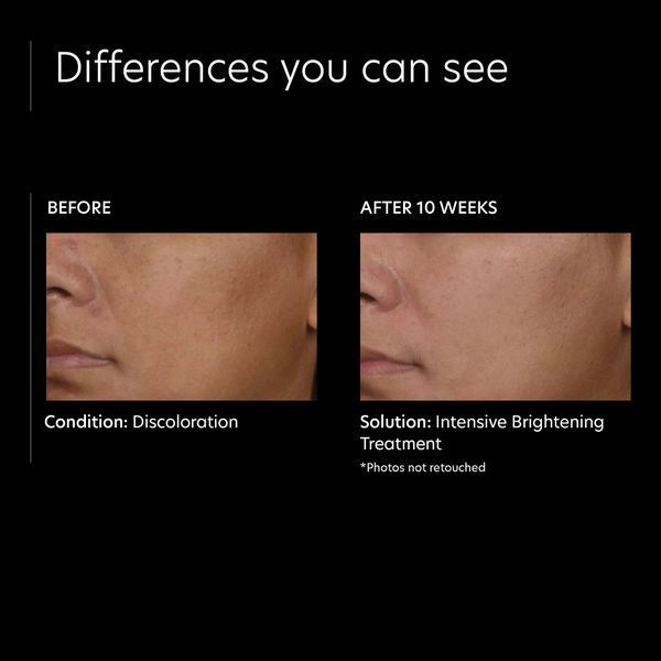 Косметичний засіб PCA Skin Intensive Brightening Treatment, 30 мл КОСМ01406 фото