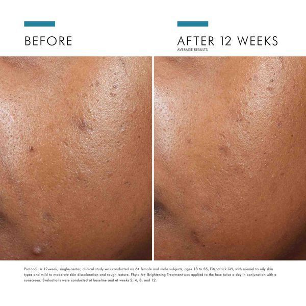 Косметичний засіб SkinCeuticals Phyto A+ Brightening Treatment, 30 мл КОСМ00207 фото