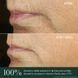 Косметичний засіб R&eacute;Vive Advanced Lip Perioral Serum Targeted Vertical Line Filler, 15 мл КОСМ00957 фото 4