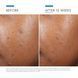 Косметичний засіб SkinCeuticals Phyto A+ Brightening Treatment, 30 мл КОСМ00207 фото 3