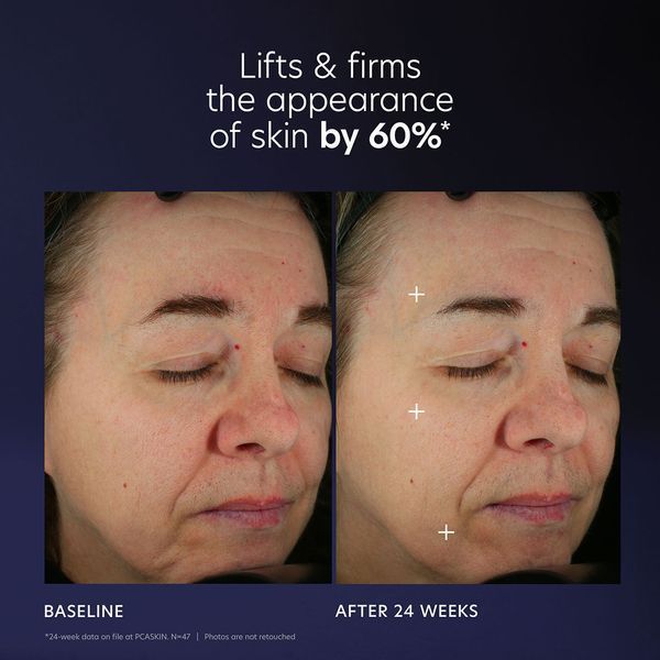 Косметичний засіб PCA Skin Pro-Max Age Renewal, 30 мл КОСМ00609 фото