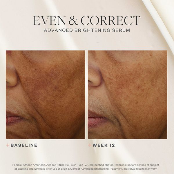 Косметичний засіб SkinMedica Even & Correct Advanced Brightening Treatment, 59 мл КОСМ01042 фото
