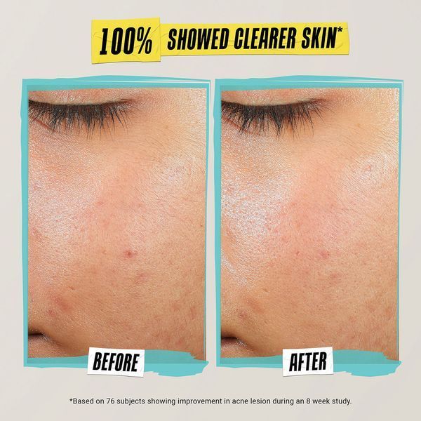 Косметичний засіб Kiehl's Since 1851 Expertly Clear Acne-Treating & Preventing Lotion, 59 мл КОСМ01592 фото