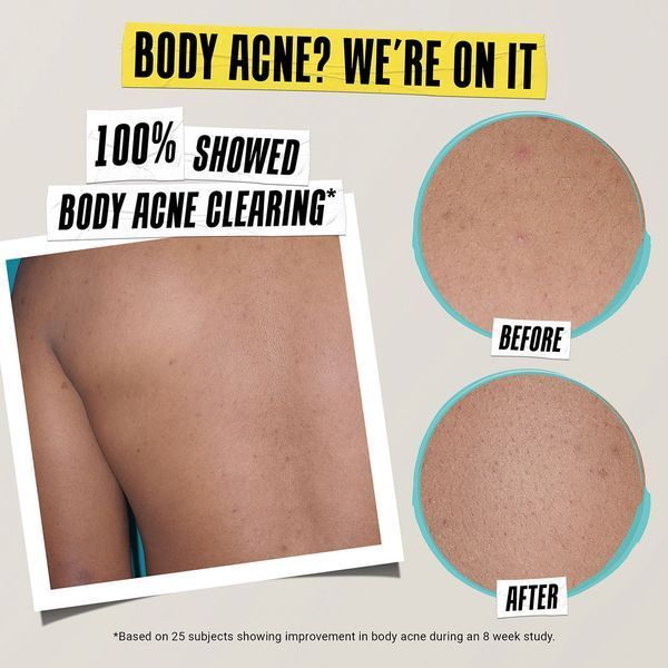 Косметичний засіб Kiehl's Since 1851 Expertly Clear Acne-Treating & Preventing Lotion, 59 мл КОСМ01592 фото