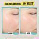 Косметичний засіб Kiehl's Since 1851 Expertly Clear Acne-Treating & Preventing Lotion, 59 мл КОСМ01592 фото 4