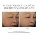 Косметичний засіб SkinMedica Even & Correct Advanced Brightening Treatment, 59 мл КОСМ01042 фото 4
