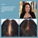 Hairmax LaserComb Ultima 9 Classic &mdash; лазерний гребінець для росту волосся HM-1000 фото 3