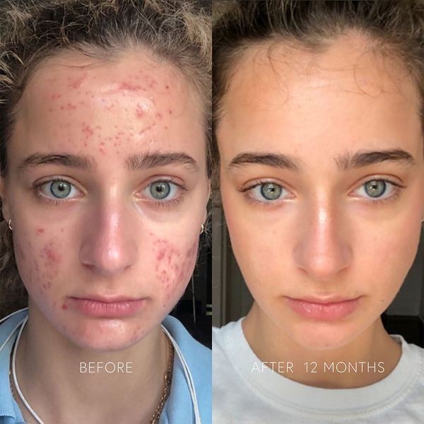 Косметичний засіб Dr. Barbara Sturm Clarifying Face Cream, 50 мл КОСМ01262 фото