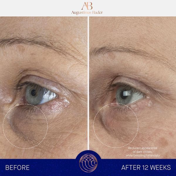 Косметичний засіб Augustinus Bader The Eye Cream Nomad, 15 мл КОСМ02162 фото