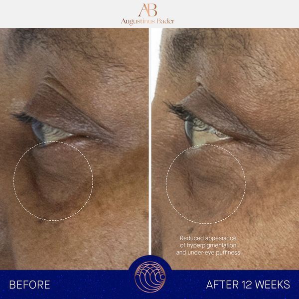 Косметичний засіб Augustinus Bader The Eye Cream Nomad, 15 мл КОСМ02162 фото