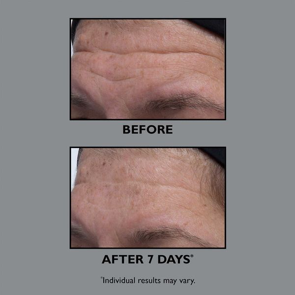 Косметичний засіб Peter Thomas Roth FIRMx Collagen Serum, 30 мл КОСМ01162 фото