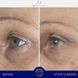 Косметичний засіб Augustinus Bader The Eye Cream Nomad, 15 мл КОСМ02162 фото 3