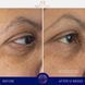 Косметичний засіб Augustinus Bader The Eye Cream Nomad, 15 мл КОСМ02162 фото 5