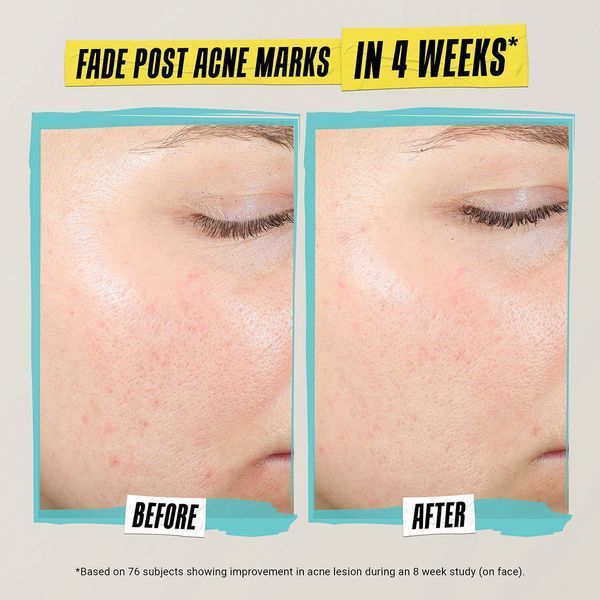 Косметичний засіб Kiehl's Since 1851 Expertly Clear Acne-Treating & Preventing Lotion, 59 мл КОСМ05563 фото