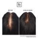Hairmax Ultima 12 LaserComb &mdash; лазерний гребінець для росту волосся HM-1002 фото 4