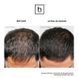 Hairmax Ultima 12 LaserComb &mdash; лазерний гребінець для росту волосся HM-1002 фото 5