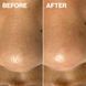 Косметичний засіб Dermaflash Dermapore+ Blush, 207 мл КОСМ04863 фото 3