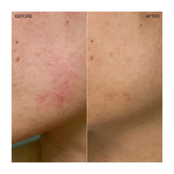 Косметичний засіб Ogee Targeted Blemish Treatment, 10 мл КОСМ00966 фото