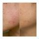 Косметичний засіб Ogee Targeted Blemish Treatment, 10 мл КОСМ00966 фото 3