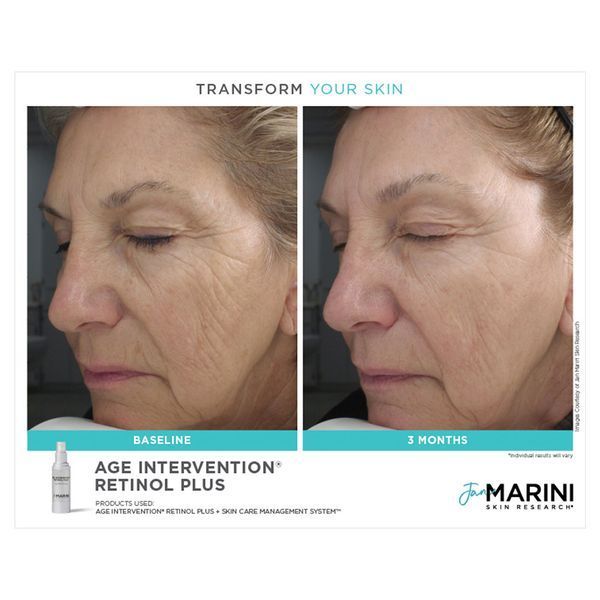 Косметичний засіб Jan Marini Age Intervention Retinol Plus, 30 мл КОСМ01467 фото