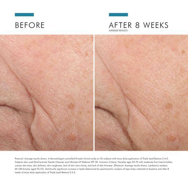 Косметичний засіб SkinCeuticals Triple Lipid Restore 2:4:2, 47 мл КОСМ05518 фото