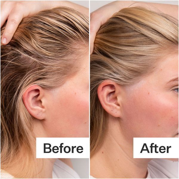 Косметичний засіб Act+Acre 4% Niacinamide Oily Scalp Serum, 65 мл КОСМ03219 фото