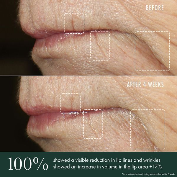 Косметичний засіб R&eacute;Vive Advanced Lip Perioral Serum Targeted Vertical Line Filler, 15 мл КОСМ02570 фото