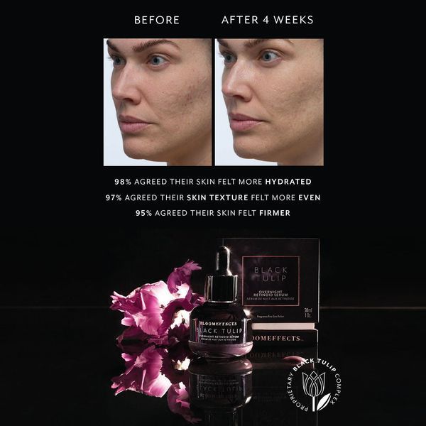 Косметичний засіб Bloomeffects Black Tulip Overnight Retinoid Serum, 30 мл КОСМ01370 фото