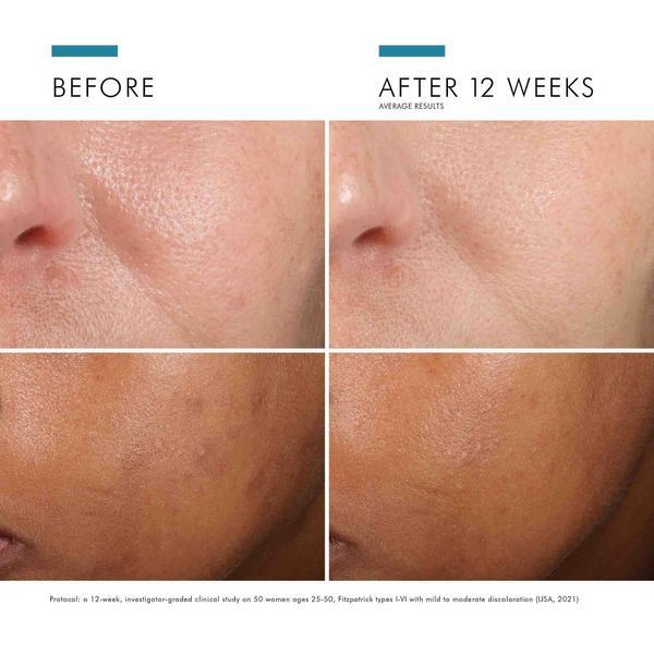 Косметичний засіб SkinCeuticals Phloretin CF, 30 мл КОСМ00171 фото