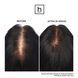 Hairmax LaserBand 82 ComfortFlex &mdash; лазерний пристрій для росту волосся HM-1010 фото 6