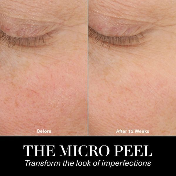 Косметичний засіб La Mer The Micro Peel, 30 мл КОСМ00622 фото