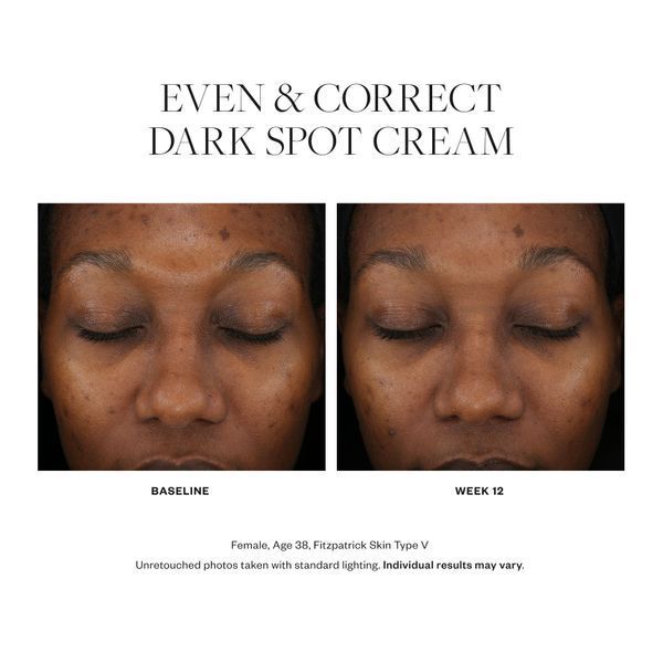 Косметичний засіб SkinMedica Even & Correct Dark Spot Cream, 15 мл КОСМ00922 фото