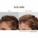 Hairmax Actonis Hair & Scalp &mdash; харчова добавка для волосся та шкіри голови HM-1011 фото 11