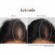 Hairmax Actonis Hair & Scalp &mdash; харчова добавка для волосся та шкіри голови HM-1011 фото 10