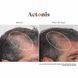 Hairmax Actonis Hair & Scalp &mdash; харчова добавка для волосся та шкіри голови HM-1011 фото 8