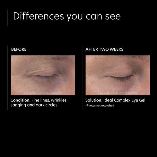 Косметичний засіб PCA Skin Ideal Complex Revitalizing Eye Gel, 15 мл КОСМ02123 фото