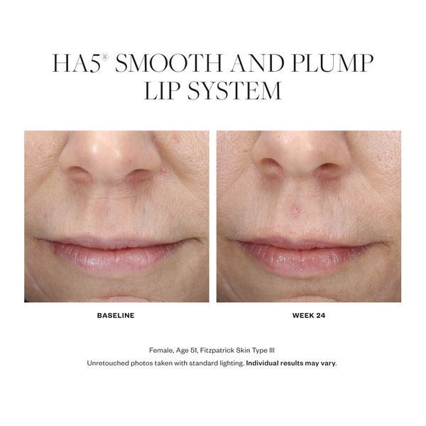 Косметичний засіб SkinMedica HA5 Smooth and Plump Lip System, 1 мл КОСМ00923 фото